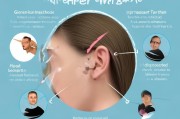 耳洞增生怎么办？6个科学方法帮你远离红肿疙瘩